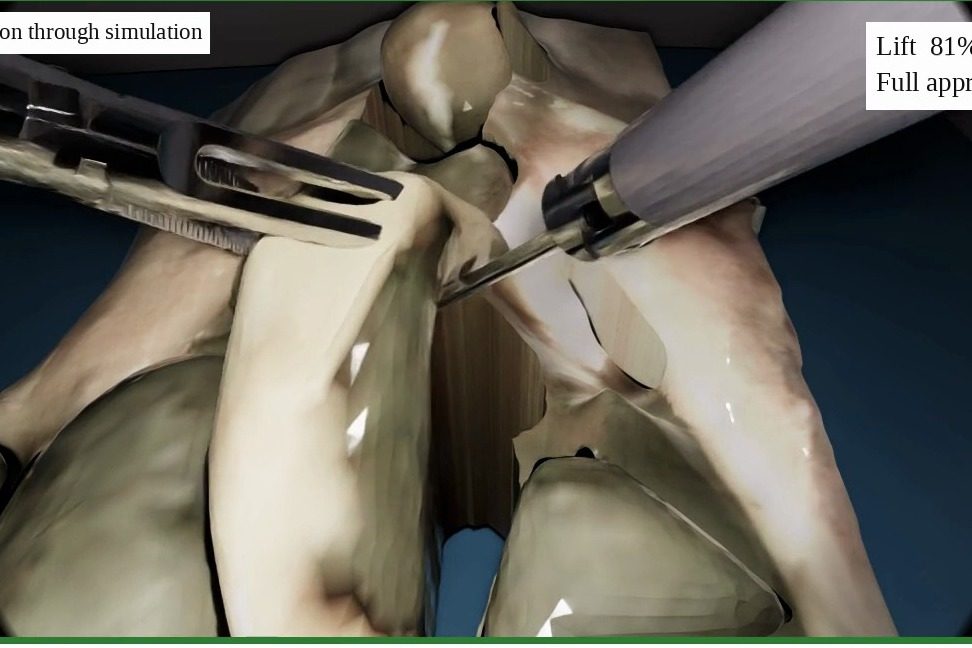 Simulated endoscope view of two instruments grasping reconstructed rabbit organs